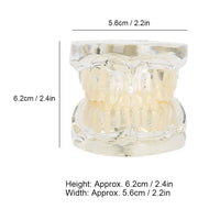 1 x RAW Customer Returns Tooth Model for Deciduous Teeth, Model for Removable Teeth, Simulation of Pathological Repair, Teaching Tool for Dentist Demonstration - RRP €33.53