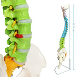 1 x RAW Customer Returns EVOTECH SCIENTIFIC Spine Model, 34.3 87cm Painted Flexible Life Size Spine Model with Stand, Chiropractic with Pelvis, Spine, Nerves and Vertebrae, Anatomical Spine Model - RRP €99.99