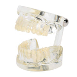 1 x RAW Customer Returns Tooth Model for Deciduous Teeth, Model for Removable Teeth, Simulation of Pathological Repair, Teaching Tool for Dentist Demonstration - RRP €33.53