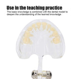 1 x RAW Customer Returns Tooth Model for Deciduous Teeth, Model for Removable Teeth, Simulation of Pathological Repair, Teaching Tool for Dentist Demonstration - RRP €33.53