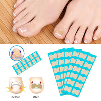 5 x Brand New Toenail Patch, Ingrown Toenail, Toenail Correction, Toenails Correction Patch, Toenail Correction Plaster, Ingrown Toenail Tool Toenails Nail Care, 50Pcs - RRP €90.0