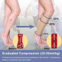 1 x RAW Customer Returns Calf Medical Compression Stockings Women Men Varicose Veins Medical Thrombosis Stockings Protection with 20-30 mmHg Class 2 Gradient Compression Beister  - RRP €11.09