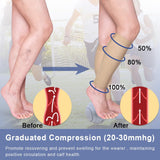 1 x RAW Customer Returns Calf Medical Compression Stockings Women Men Varicose Veins Medical Thrombosis Stockings Protection with 20-30 mmHg Class 2 Gradient Compression Beister  - RRP €11.09