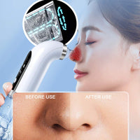 1 x RAW Customer Returns Blackhead Remover, Vacuum Pore Cleaner, Electric Pore Cleaner, USB Rechargeable, Water Cycle, Pimple Extractor - RRP €24.6