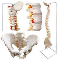 1 x RAW Customer Returns Life Size Flexible Spine Model, 33 inch 85cm Male Anatomical Spine Model with Flexible Spinal Cord, Vertebrae, Nerves, Arteries, Lumbar Spine, Pelvis and Stand - RRP €81.62