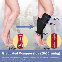 1 x RAW Customer Returns Calves Medical Compression Stockings Women Men Varicose Veins Medical Thrombosis Stockings Protection with 20-30 mmHg Class 2 Gradient Compression Beister  - RRP €19.35