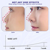 1 x Brand New Silicone Nose Corrector, Nose Shaper Clip, Nose Shaping Clip, Nose Up Lifting Clips, Nose Up Lifting Shaping Shaper To Lift And Shape Your Nose Purple  - RRP €18.0