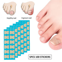 5 x Brand New Toenail Patch, Ingrown Toenail, Toenail Correction, Toenails Correction Patch, Toenail Correction Plaster, Ingrown Toenail Tool Toenails Nail Care, 50Pcs - RRP €90.0