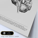 1 x RAW Customer Returns Nacnic set of 6 posters of internal organs. Collection of panels with aesthetic collage for interior decoration. Sizes A3 and A4. Frameless - RRP €25.9