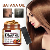 2 x Brand New Organic Batana Oil for Hair Growth,Batana Oil for Hair Growth,Thicker and Fuller Hair,Organic Batana Oil,Organic Batana Oil,Pure Batana Oil,Improves Hair Radiance Bee Venom - RRP €22.18