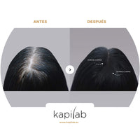 1 x RAW Customer Returns Kapilab Hair Makeup Scalp Mask - 4g - Light Brown - RRP €19.95