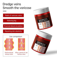 2 x Brand New Skin Smoothing Cream,Varicose Veins Cream,Varicose Veins Cream for Legs,Varicose Vein Soothing Leg Cream,Spider Veins Removal Cream,Spider Veins Removal Cream,Varicose Vein Soothing Leg Cream - RRP €12.76