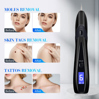 1 x RAW Customer Returns AKTETCN Skin Tag Remover Kit Tools with LCD Display 9 Adjustable Modes 30 Fine Needles USB Charging Home Use for Tattoo Freckle Wart Dark Spot Nevus Body Face Black  - RRP €18.0